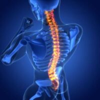 SpinalCordInjury